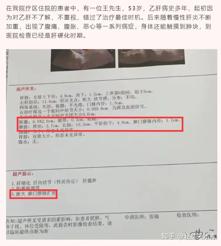 肝硬化脾大不要怕，更不要“一刀切”！(图1)