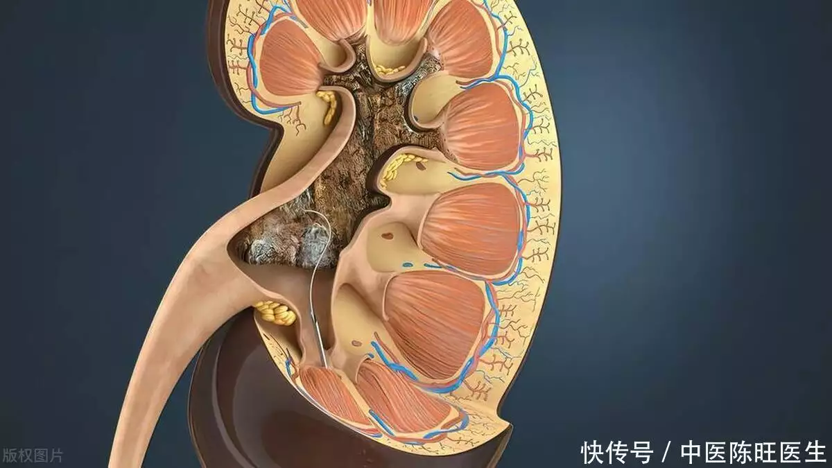 肾囊肿可以吃三七粉吗?吃之前，最好先明确3件事(图4)