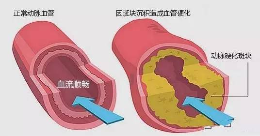 （脾肾阳虚型高脂血症）人参海参扁豆粥(图1)