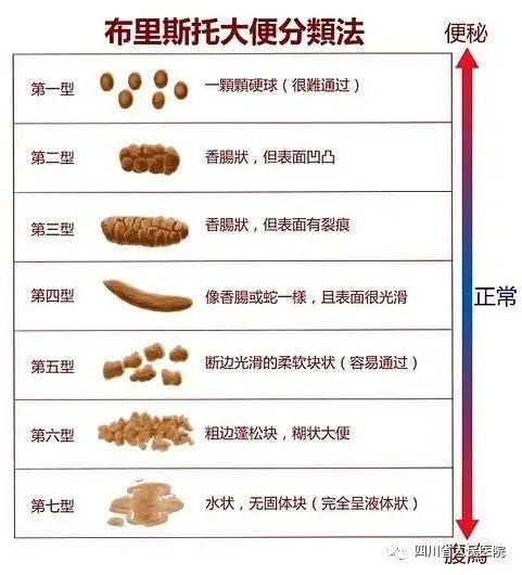 「健康资讯」长期肚子不舒服，警惕“肠易激综(图4)