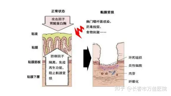 想要彻底治愈胃炎？那你应该这样做！(图3)