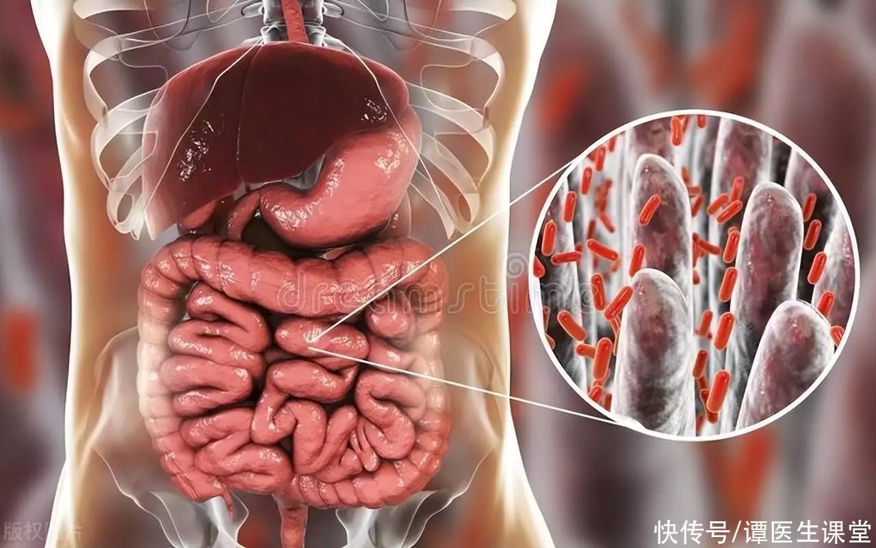 提醒：肠癌的3个早期症状，不只是“便血”，要(图3)