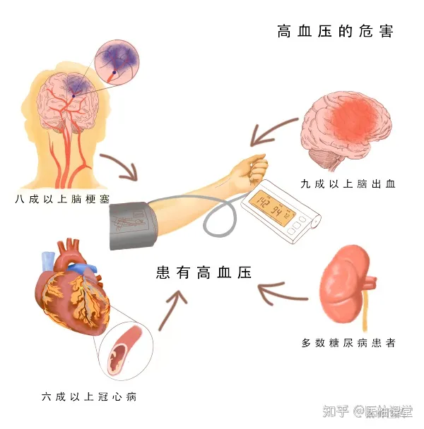 11张高血压科普图片，清晰明了，简单易懂！(图3)