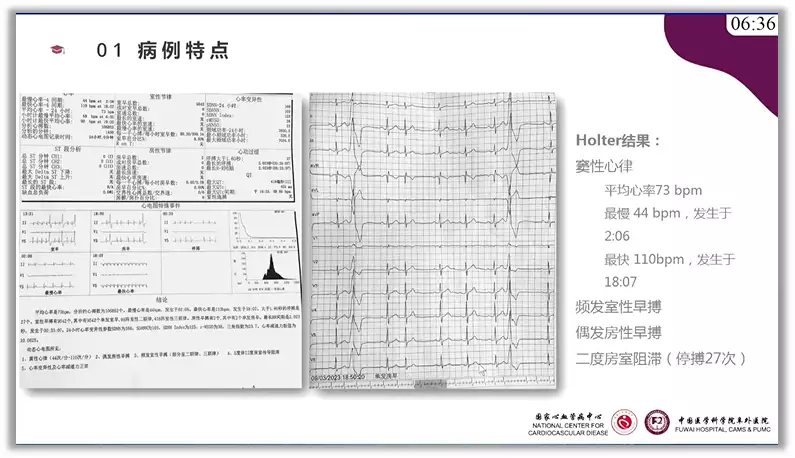 突破心律失常药物治疗瓶颈 临床典型病例提升诊(图1)