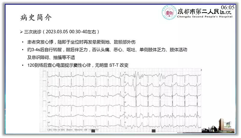 突破心律失常药物治疗瓶颈 临床典型病例提升诊(图4)