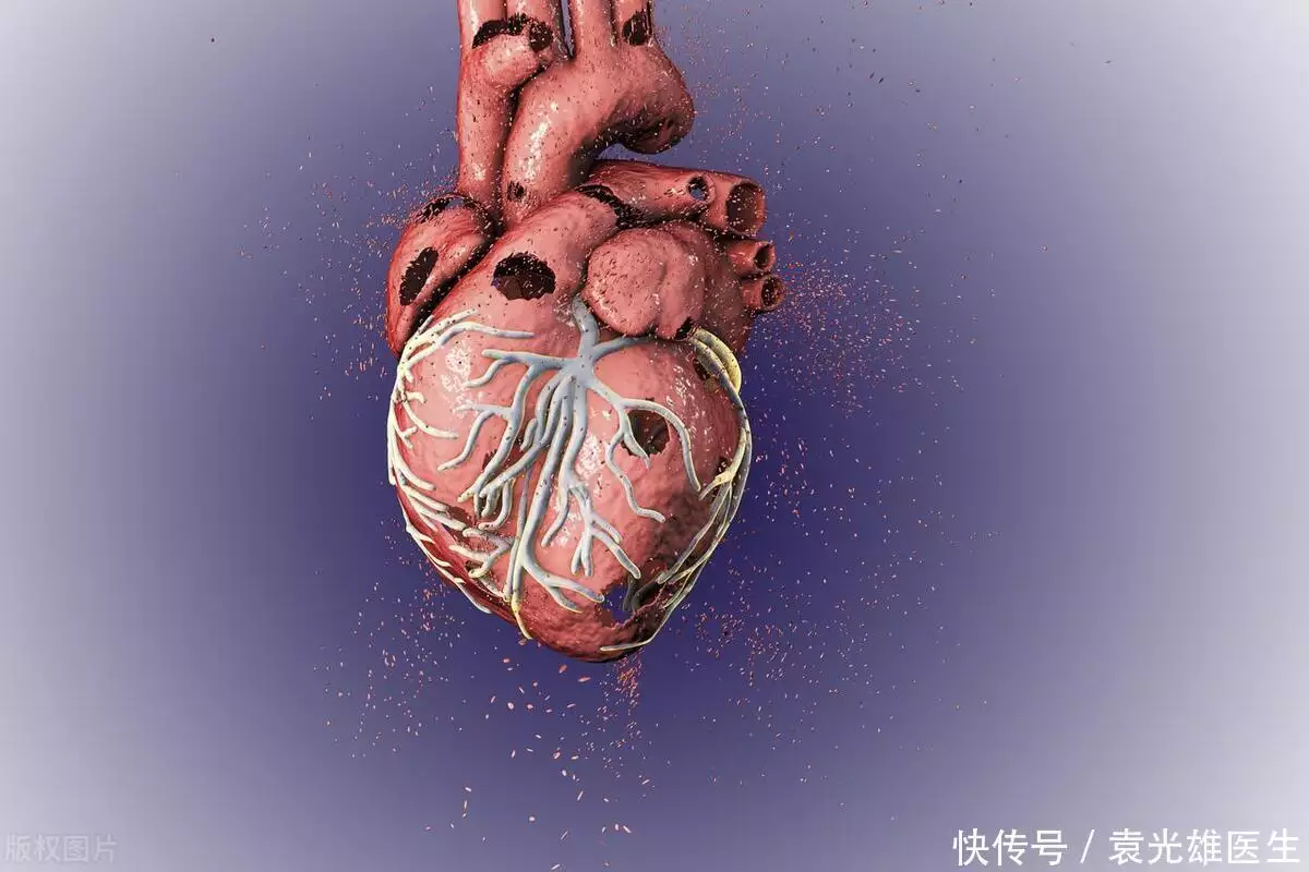 心跳不整齐的感觉是心衰的信号吗？早搏可不可(图1)