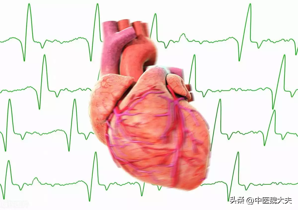 心跳不规律，可能是心律失常！做好预防，守护(图2)