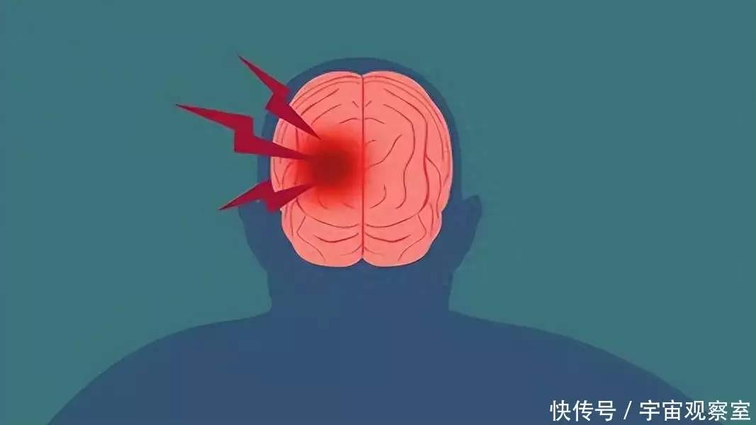 脑出血的八大症状和六点急救要点，保护生命安(图3)