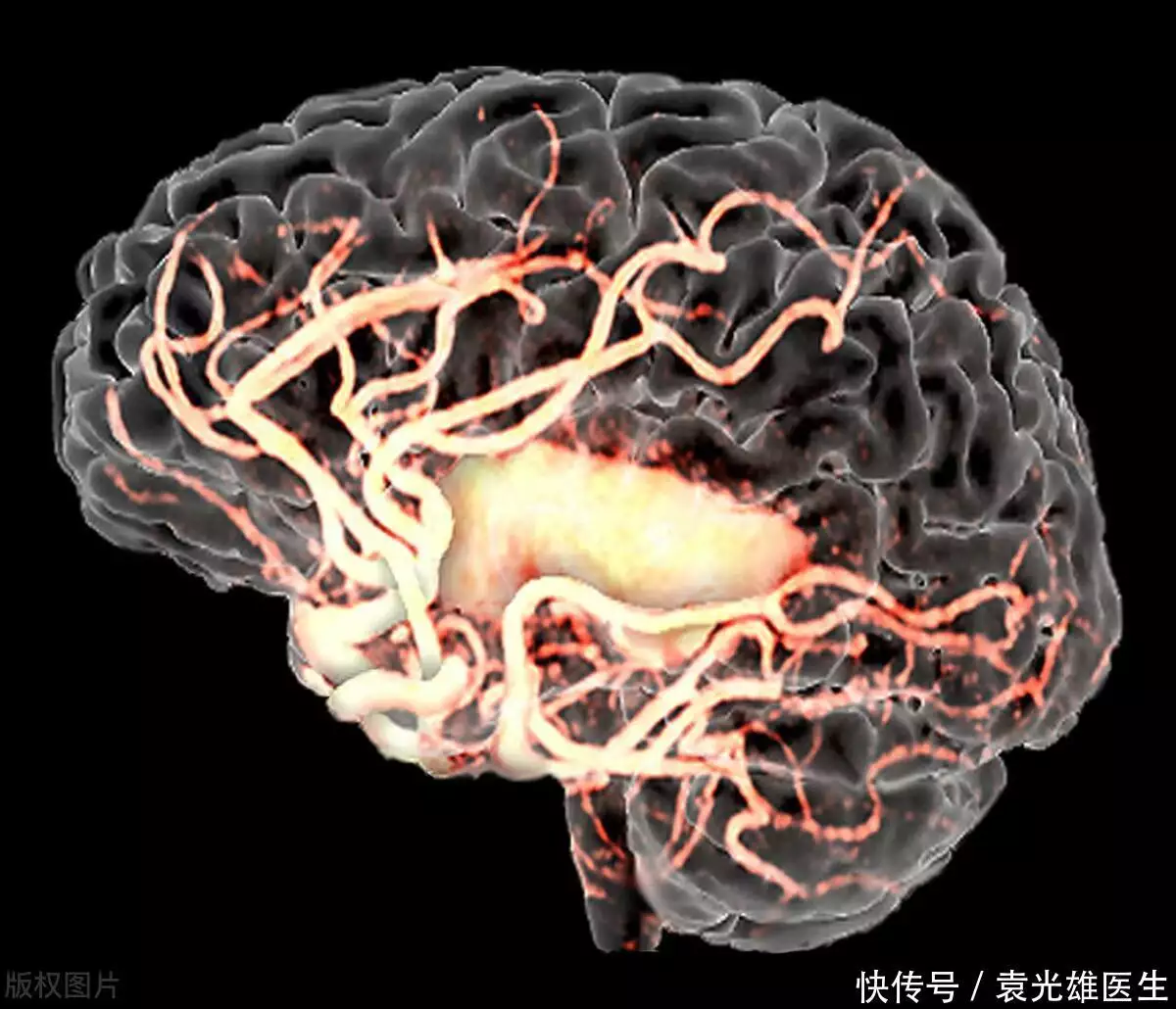 医生提醒：元旦过后气温回暖，心脑血管疾病患(图4)