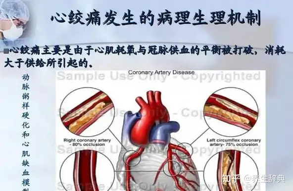 心绞痛的5大病因！提早预防，远离心绞痛(图3)