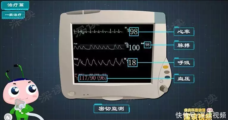 治心梗开刀还是吃药？硝酸甘油能救命？心肌梗(图4)