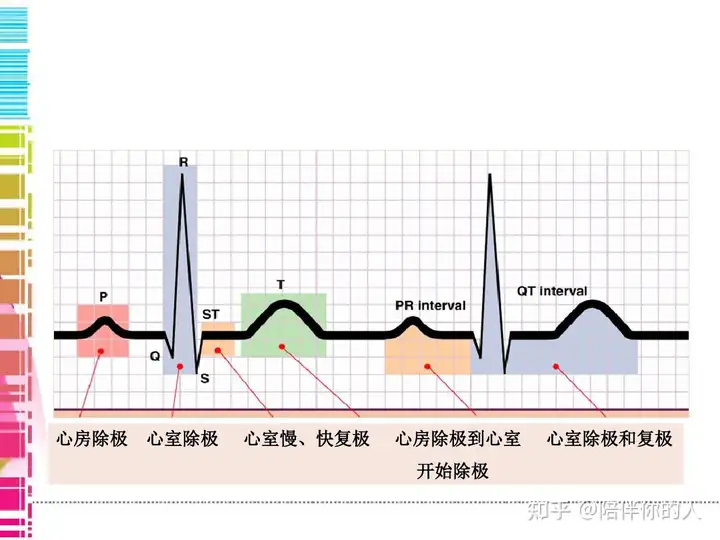 心律失常的原因和预防以及治疗(图4)