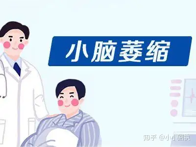 日常做到这5点，预防脑萎缩！(图1)