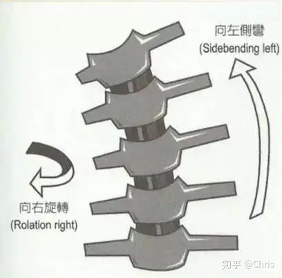 彻底了解脊柱侧弯(图7)