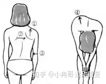 关于脊柱侧弯，你了解几分？(图2)