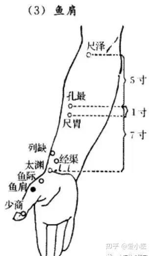 什么是肩周炎？如何调理(图2)