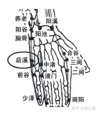 什么是肩周炎？如何调理(图5)