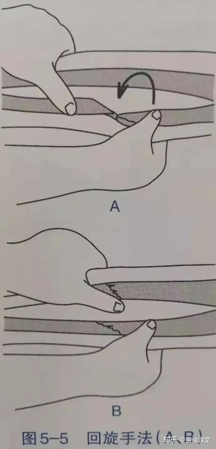 骨折的整复手法，全面总结到位！(图4)