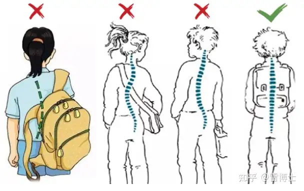 脊柱侧弯预防有法宝：站好 坐好 躺好 背好(图9)