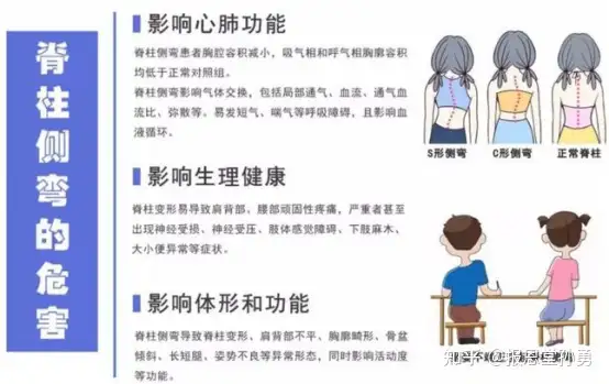 脊柱侧弯给我们带来的影响，需要如何有效的预(图2)