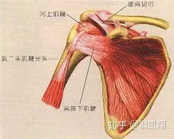 肩周炎最佳治疗方法是什么？(图2)