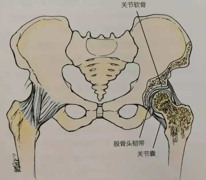 髋关节疼痛、僵硬、活动受限，髋关节骨性关节(图1)