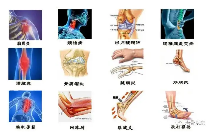 治腰间盘突出小妙招,教你治疗腰间盘突出(图1)