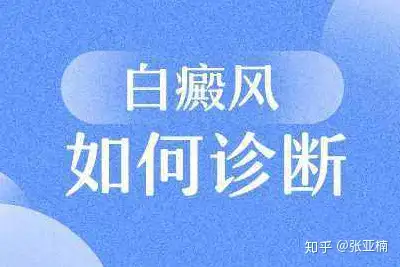 白癜风怎么治疗？了解一下正确方法(图1)