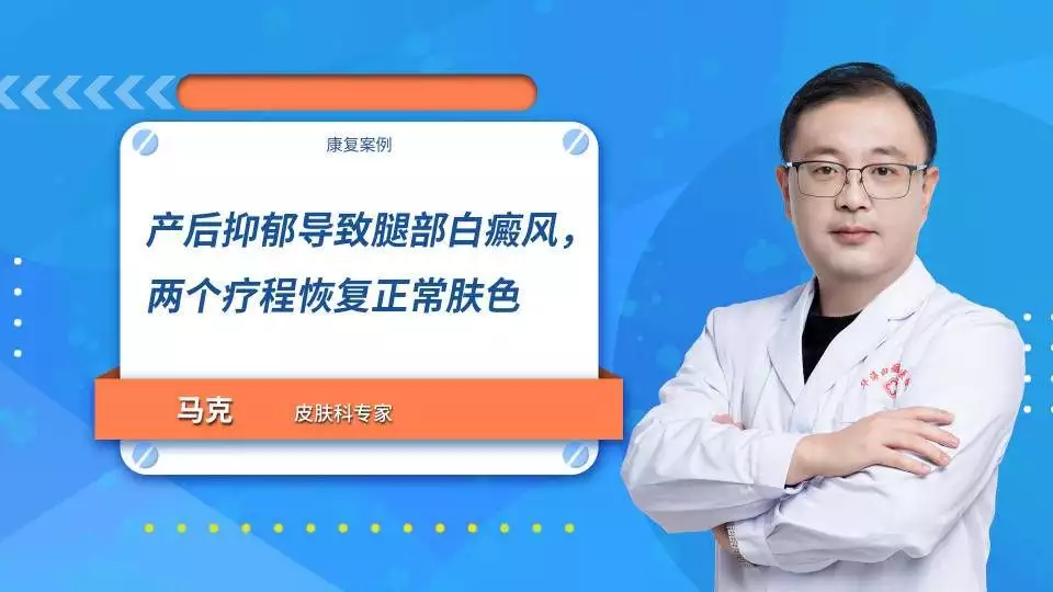 精神抑郁导致的白癜风怎么治疗好？片约不断却(图1)