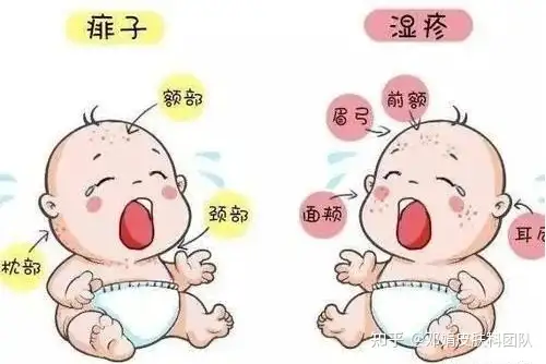 得了湿疹怎么办？邓主任教你如何治疗！(图3)