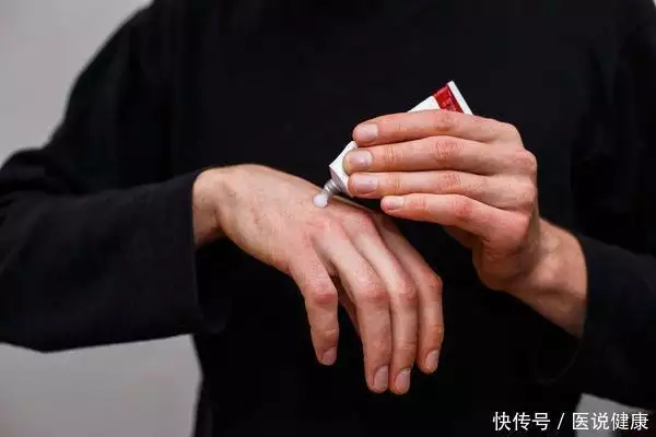 湿疹、皮炎等常见皮肤病，如何用药，才能有效(图4)