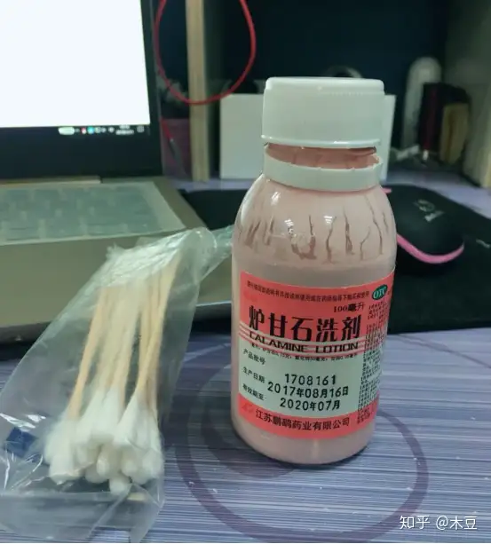 怎样预防荨麻疹？(图7)