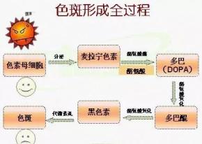 想要祛斑？先要预防黑色素沉着(图4)