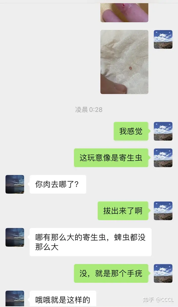 我的手疣/寻常疣治疗经验（2021.05.27）(图5)