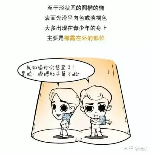 南京肤康：生活中如何预防扁平疣(图4)