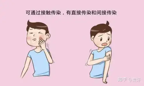 南京肤康：生活中如何预防扁平疣(图5)