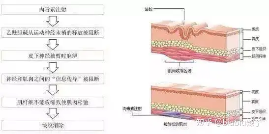 常见的注射型医美有哪些？你知道吗？(图6)