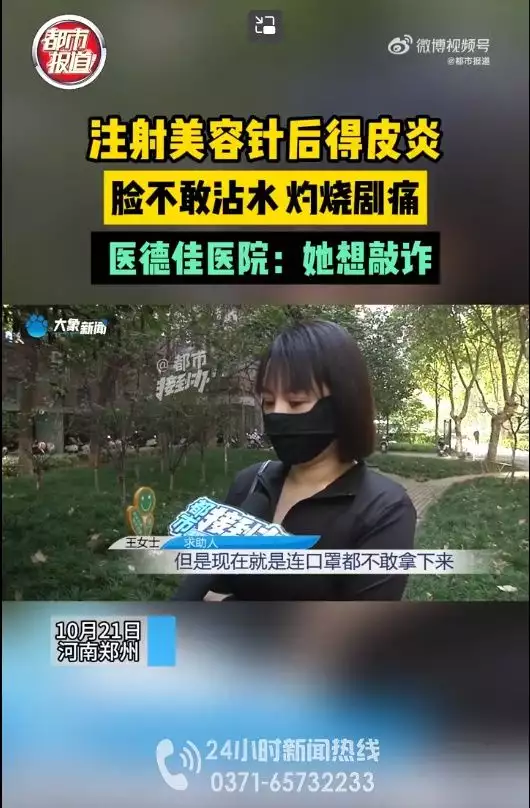 女子注射美容，脸部剧痛感染五十年代，主席和(图1)