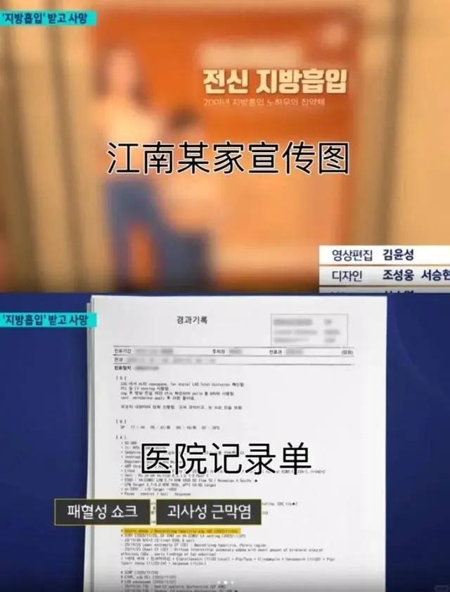 中国女孩赴韩整形后身亡！两周内做了三次抽脂(图5)