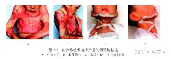 北京八大处整形医院怎么样？(图13)