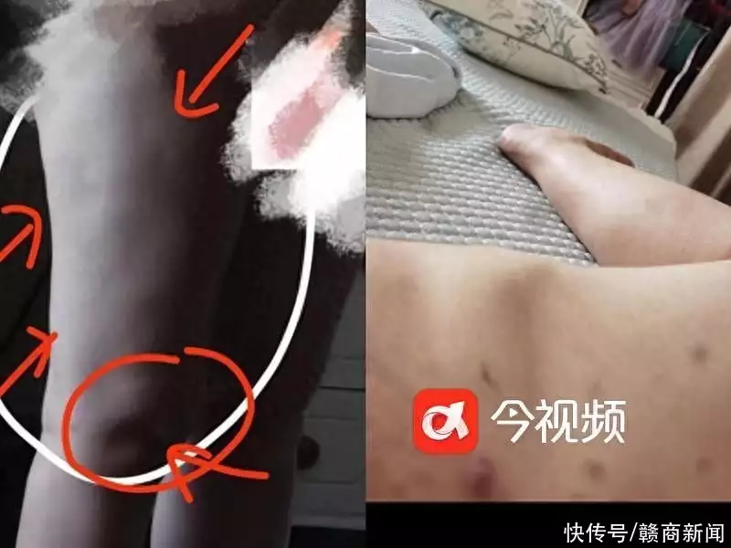 南昌一女士花十几万在“优壹美”整形失败 却遭(图1)