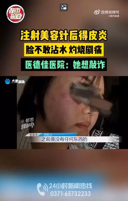 女子注射美容，脸部剧痛感染女明星素颜：罗海(图2)