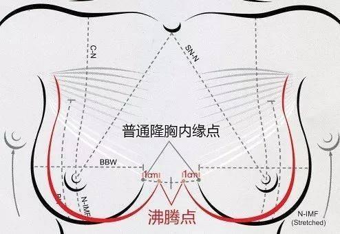 盘点中国的隆胸医生哪个技术比较好？齐鲁壹点(图1)