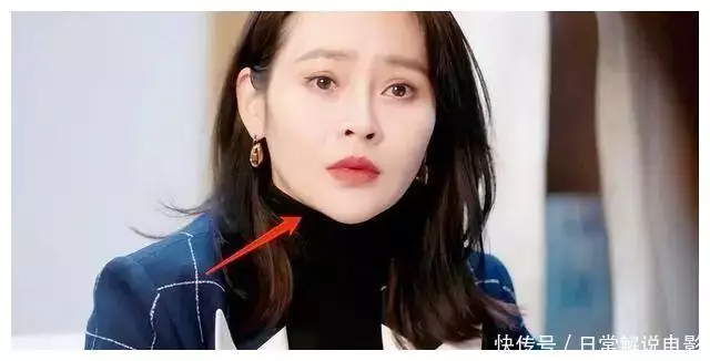 个个顶着一张“假”脸，这5位“医美”女星，别(图11)