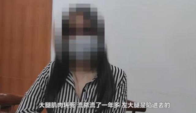 女歌手整形后多处淤血，索赔120万，医院：人没(图3)