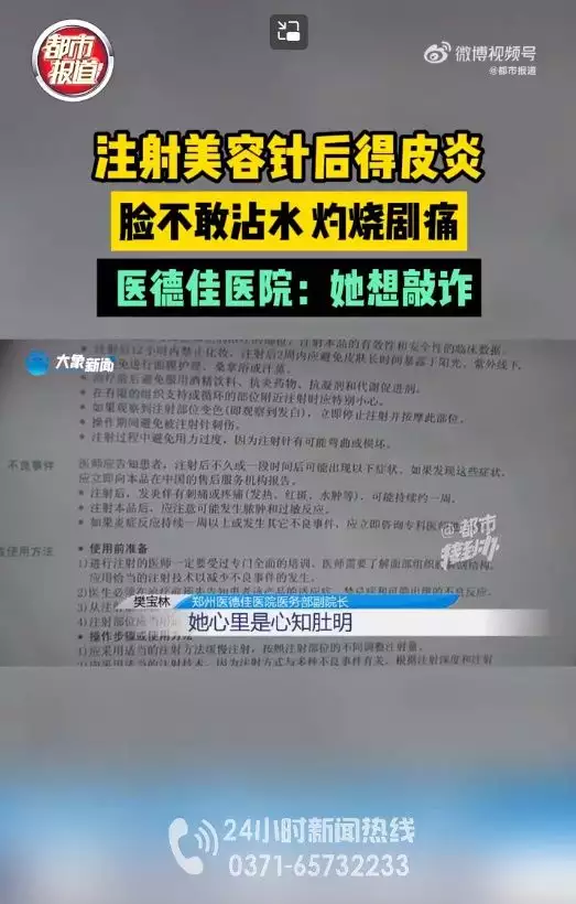 女子注射美容，脸部剧痛感染47岁李小冉：娱乐圈(图3)