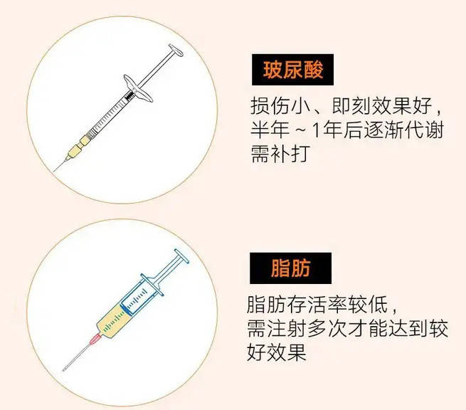 鼻基底凹陷如何改善？如何判断鼻基底是否凹陷(图5)