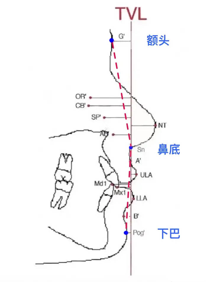 鼻基底凹陷如何改善？如何判断鼻基底是否凹陷(图3)