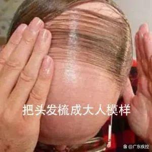 贾玲减了100斤冲上热搜！暴瘦不可取，想科学减(图12)